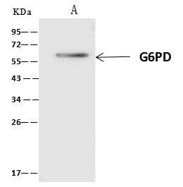 G6PD Antibody in Immunoprecipitation (IP)