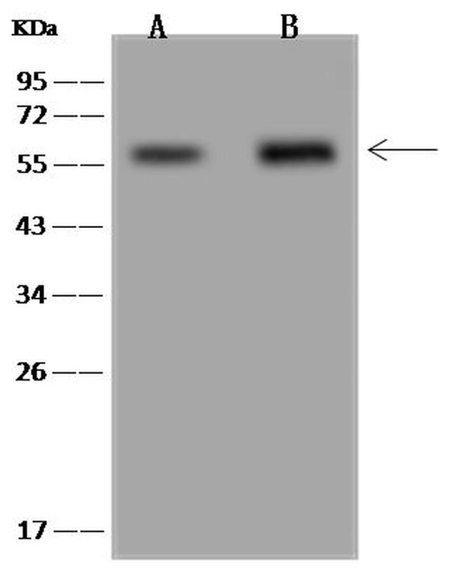 G6PD Antibody in Western Blot (WB)