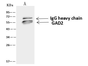GAD65 Antibody in Immunoprecipitation (IP)