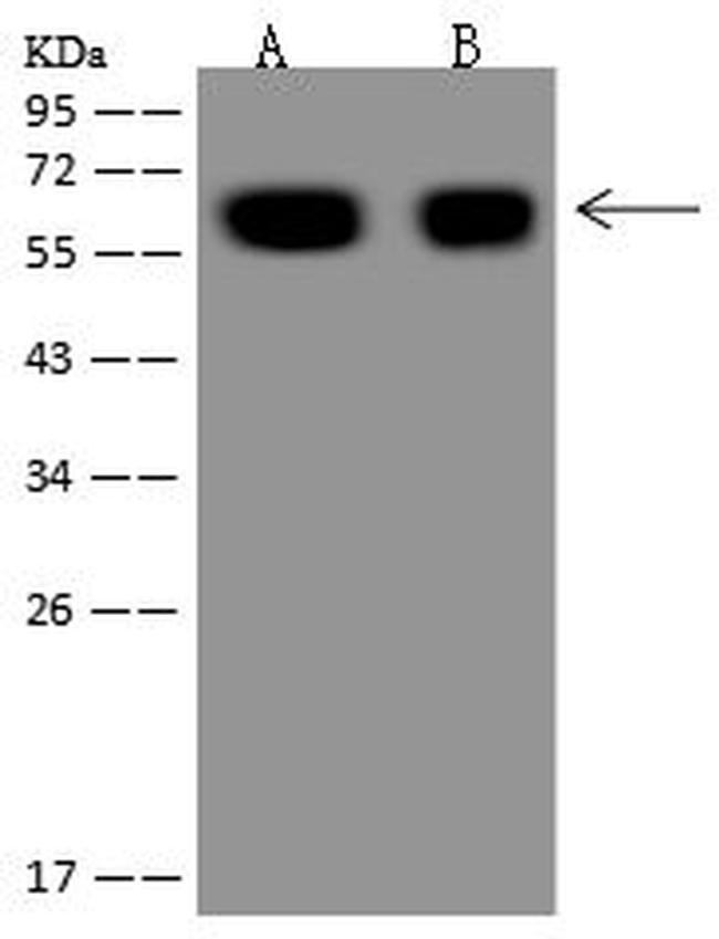 GAD65 Antibody in Western Blot (WB)