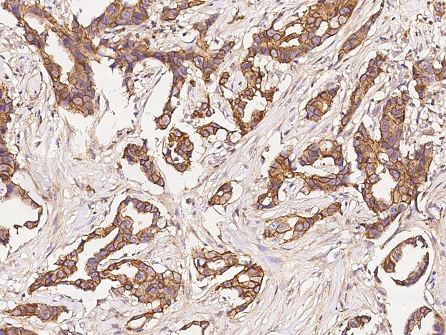 GAP43 Antibody in Immunohistochemistry (Paraffin) (IHC (P))