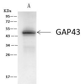 GAP43 Antibody in Immunoprecipitation (IP)