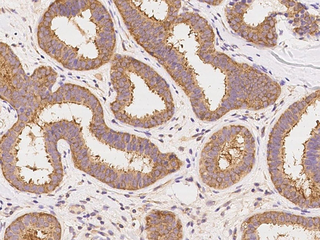 GART Antibody in Immunohistochemistry (Paraffin) (IHC (P))