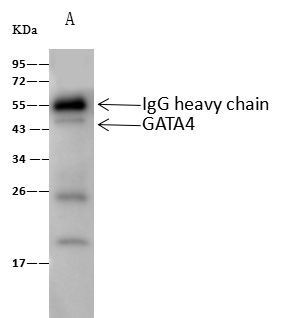 GATA4 Antibody in Immunoprecipitation (IP)