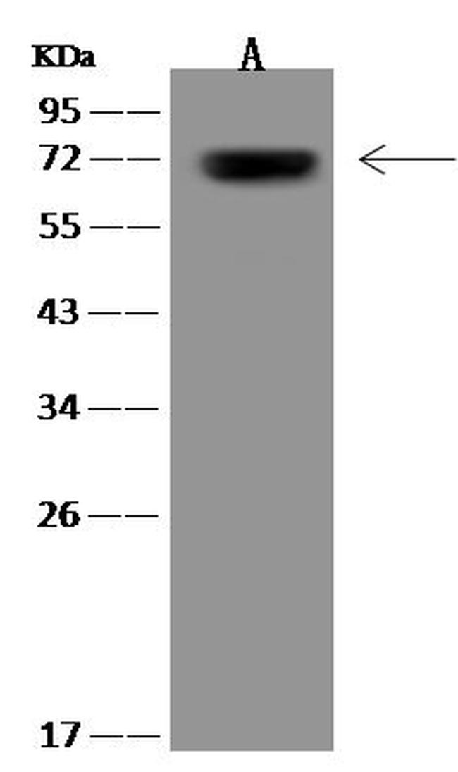 GBP1 Antibody in Western Blot (WB)