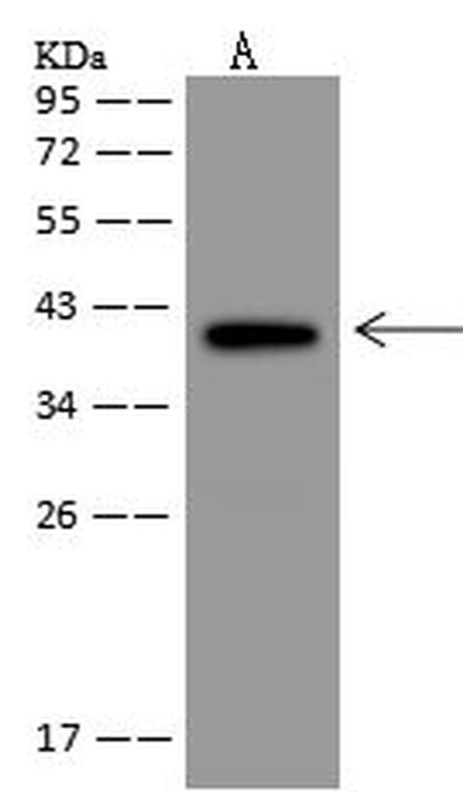 GDPGP1 Antibody in Western Blot (WB)