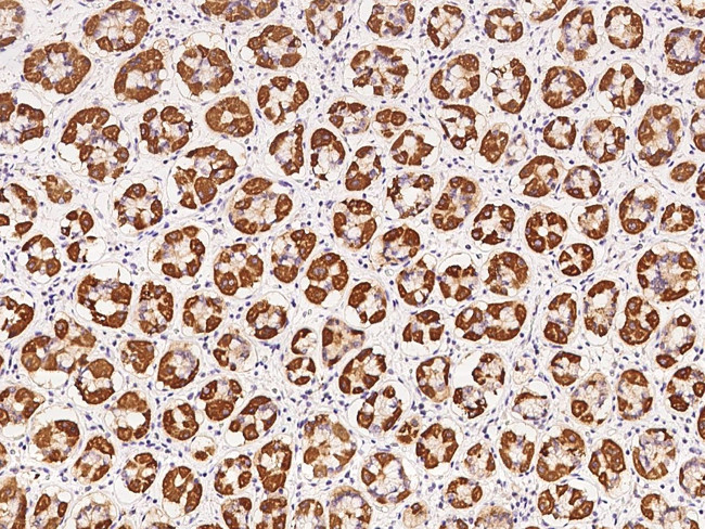 GPT2 Antibody in Immunohistochemistry (Paraffin) (IHC (P))