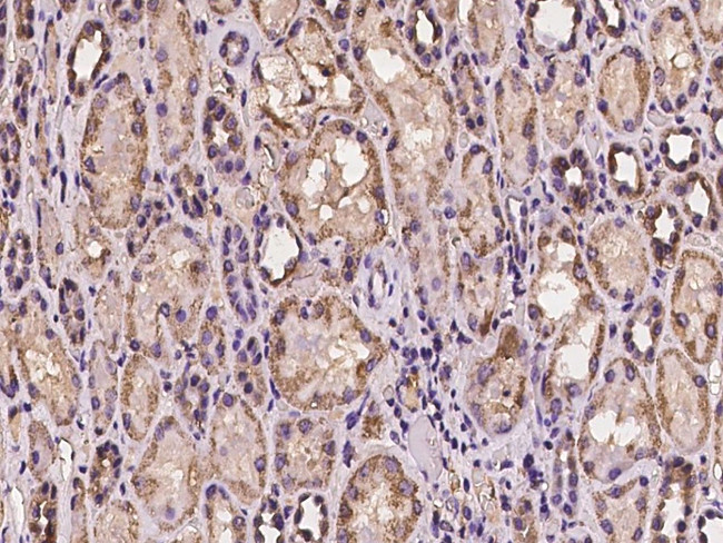 HADHB Antibody in Immunohistochemistry (Paraffin) (IHC (P))