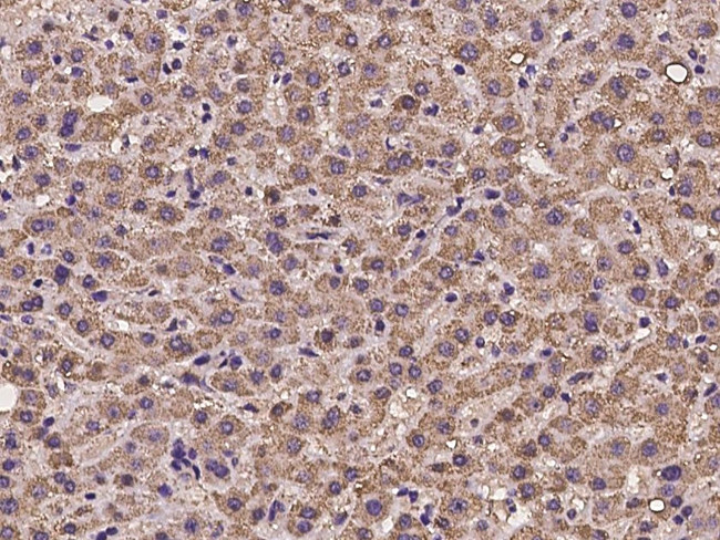 HADHB Antibody in Immunohistochemistry (Paraffin) (IHC (P))