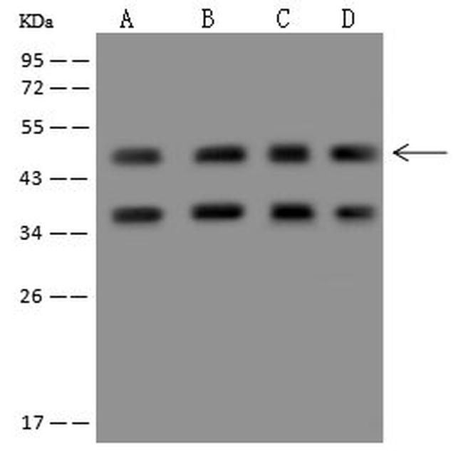 HADHB Antibody in Western Blot (WB)