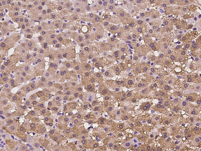 HIBCH Antibody in Immunohistochemistry (Paraffin) (IHC (P))