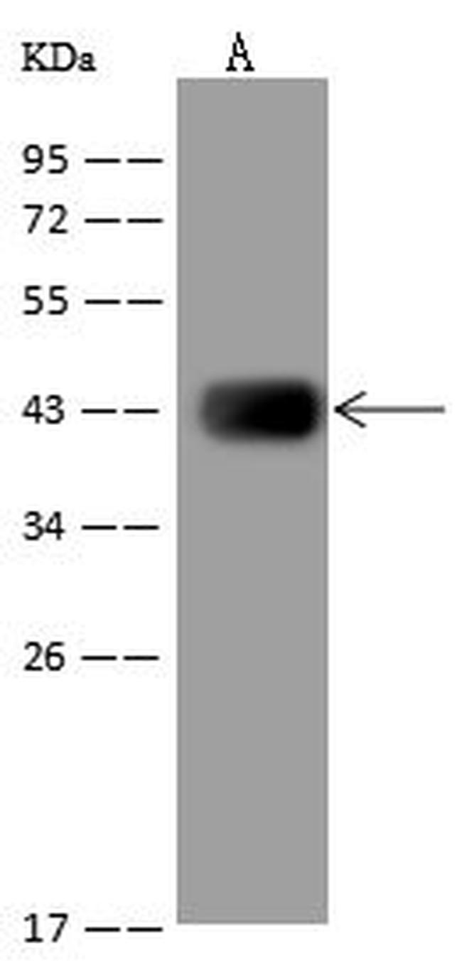 HIBCH Antibody in Western Blot (WB)