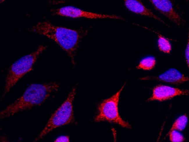 HK1 Antibody in Immunocytochemistry (ICC/IF)