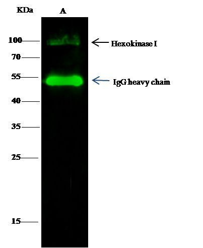 HK1 Antibody in Immunoprecipitation (IP)