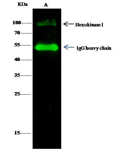 HK1 Antibody in Immunoprecipitation (IP)