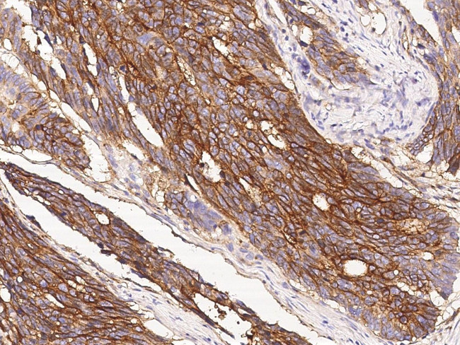 IFITM1 Antibody in Immunohistochemistry (Paraffin) (IHC (P))