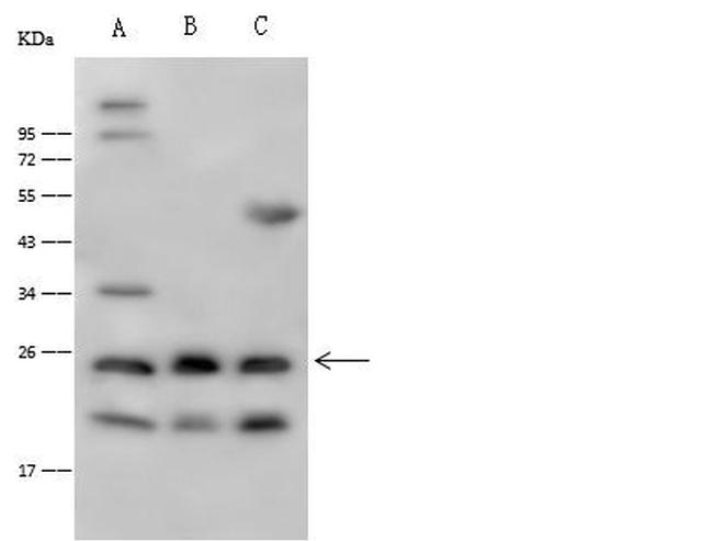 IL1F6 Antibody in Western Blot (WB)