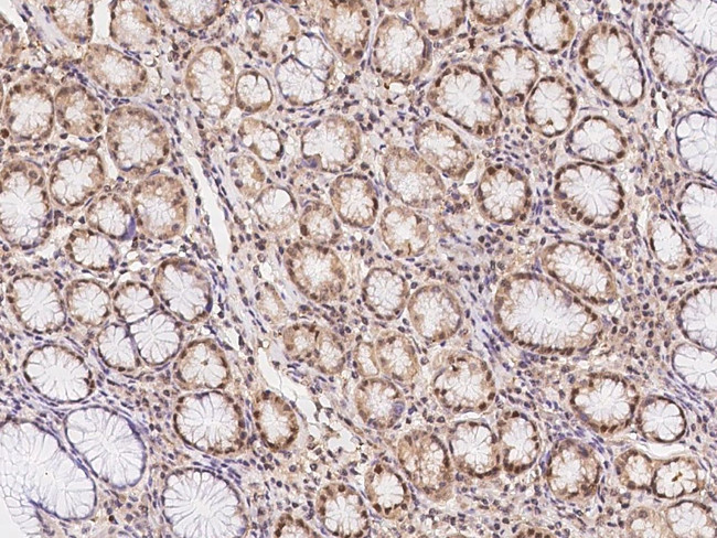 JRKL Antibody in Immunohistochemistry (Paraffin) (IHC (P))