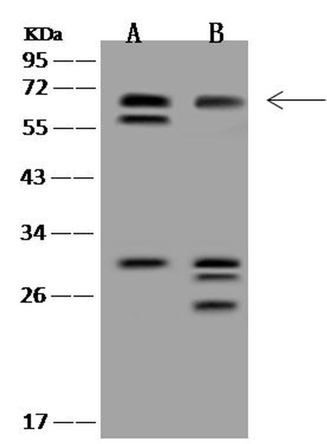 JRKL Antibody in Western Blot (WB)