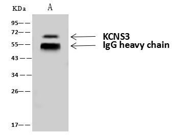 KCNS3 Antibody in Immunoprecipitation (IP)