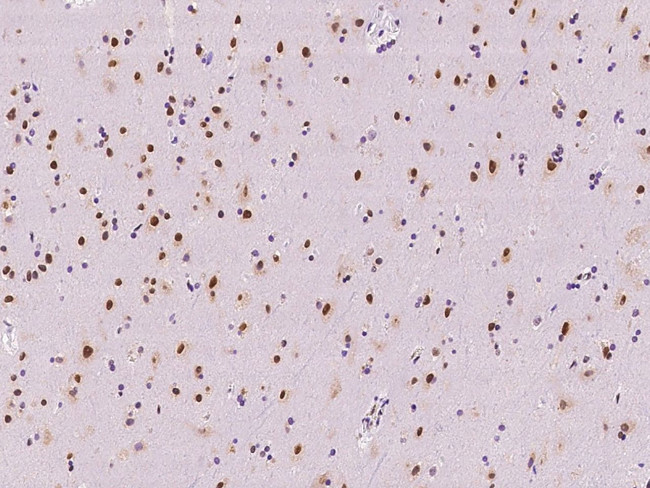 SAM68 Antibody in Immunohistochemistry (Paraffin) (IHC (P))