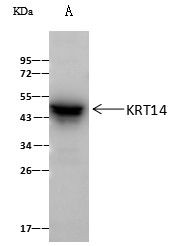 KRT14 Antibody in Immunoprecipitation (IP)