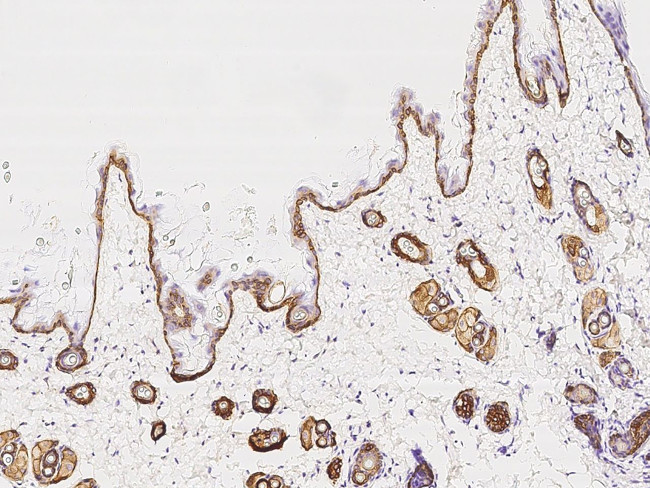 KRT14 Antibody in Immunohistochemistry (Paraffin) (IHC (P))