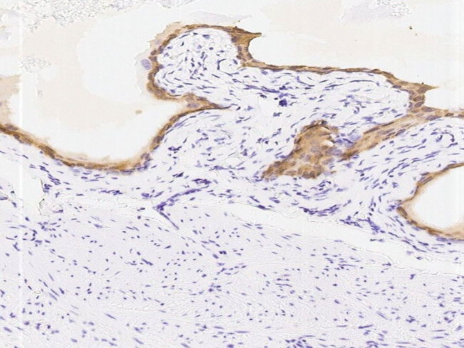 KRT14 Antibody in Immunohistochemistry (Paraffin) (IHC (P))