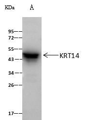 KRT14 Antibody in Immunoprecipitation (IP)