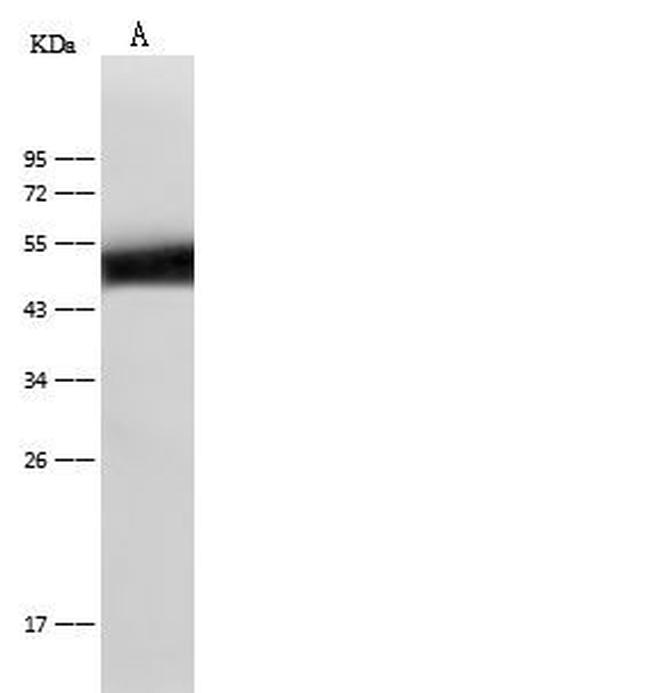 KRT14 Antibody in Western Blot (WB)