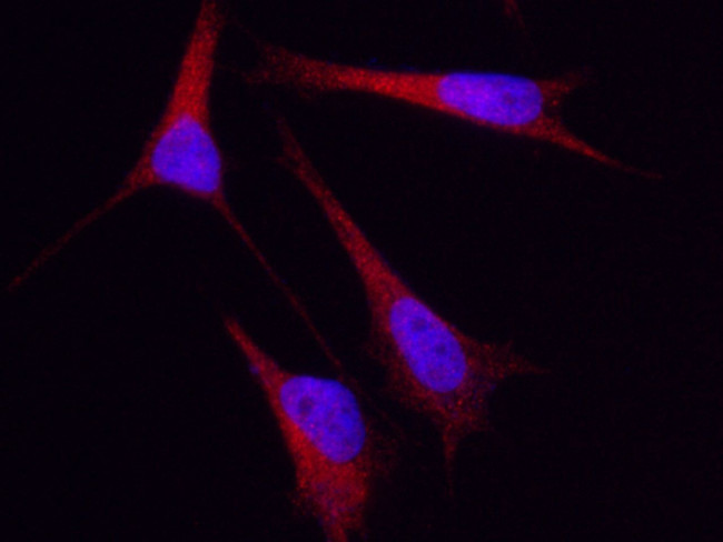 Cytokeratin 5 Antibody in Immunocytochemistry (ICC/IF)