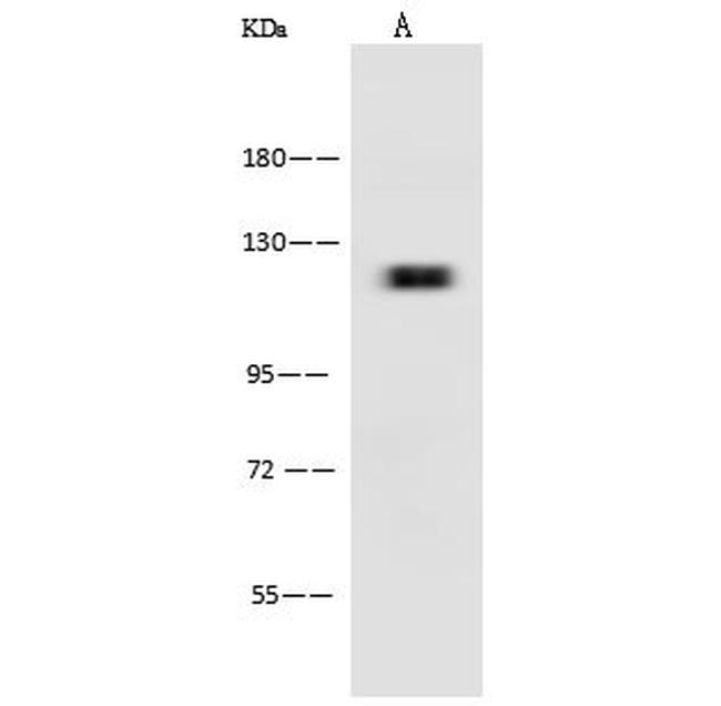 Leptin Receptor Antibody in Western Blot (WB)