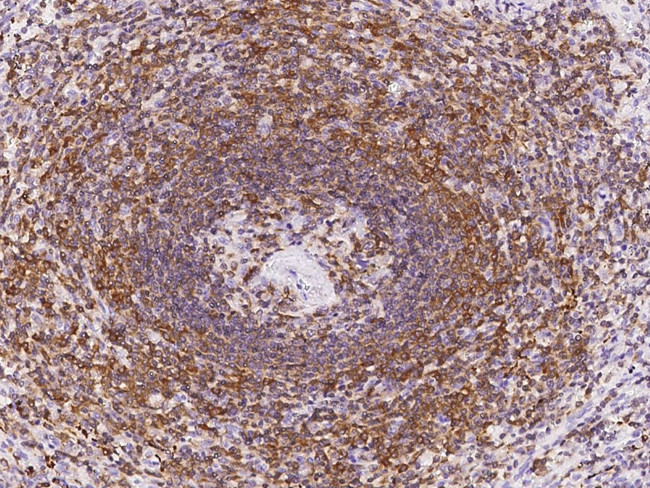 LPXN Antibody in Immunohistochemistry (Paraffin) (IHC (P))