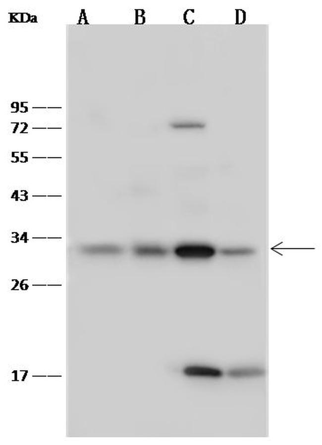 Latexin Antibody in Western Blot (WB)