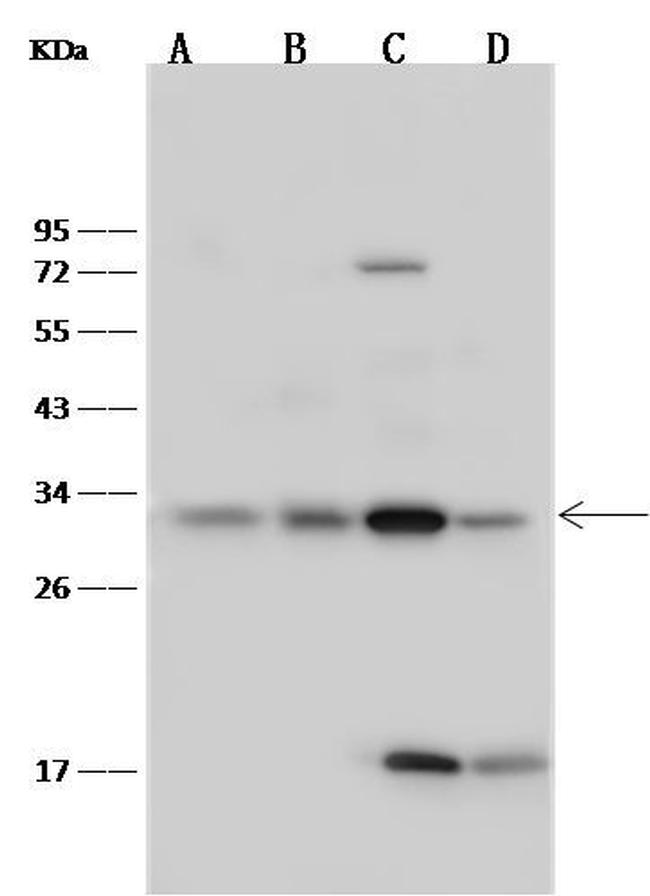 Latexin Antibody in Western Blot (WB)