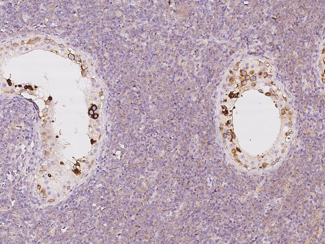 LZTFL1 Antibody in Immunohistochemistry (Paraffin) (IHC (P))