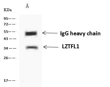 LZTFL1 Antibody in Immunoprecipitation (IP)