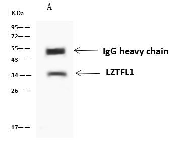 LZTFL1 Antibody in Immunoprecipitation (IP)