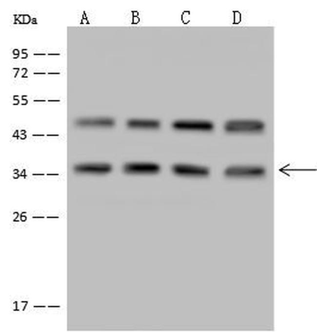 LZTFL1 Antibody in Western Blot (WB)