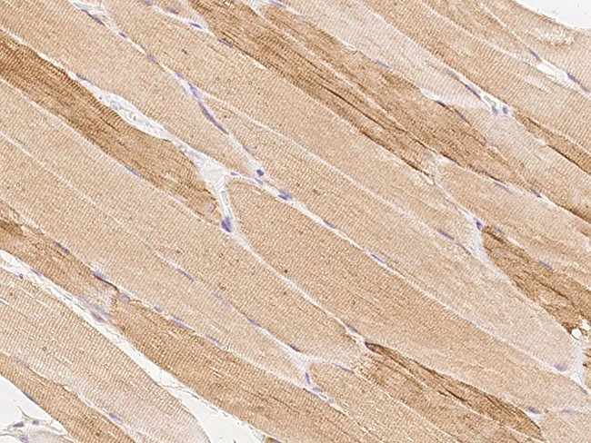 MAMLD1 Antibody in Immunohistochemistry (Paraffin) (IHC (P))