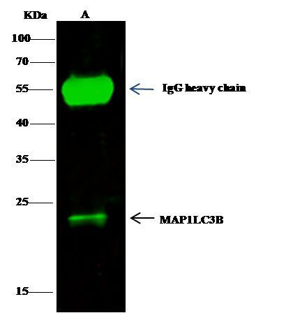 LC3B Antibody in Immunoprecipitation (IP)