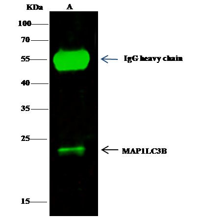 LC3B Antibody in Immunoprecipitation (IP)