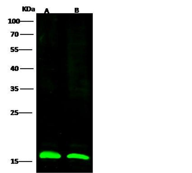 LC3B Antibody in Western Blot (WB)