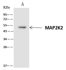 MEK2 Antibody in Immunoprecipitation (IP)