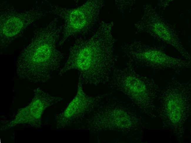 MEK3 Antibody in Immunocytochemistry (ICC/IF)