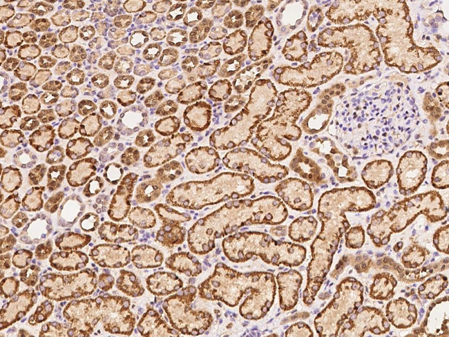 MEK3 Antibody in Immunohistochemistry (Paraffin) (IHC (P))