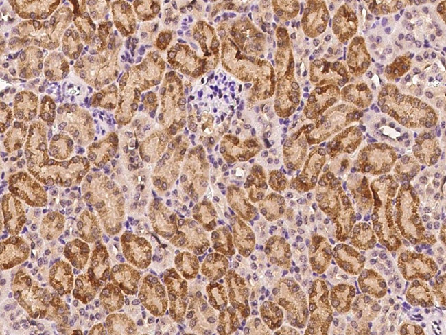 MEK3 Antibody in Immunohistochemistry (Paraffin) (IHC (P))