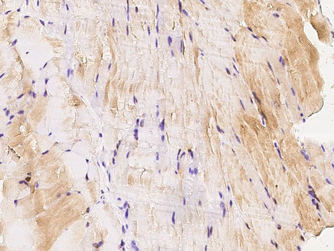 MEK3 Antibody in Immunohistochemistry (Paraffin) (IHC (P))