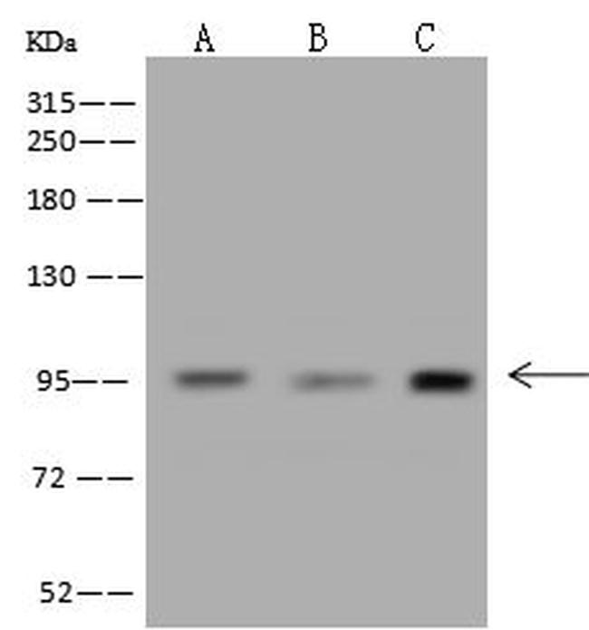 MCC Antibody in Western Blot (WB)