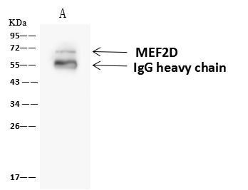 MEF2D Antibody in Immunoprecipitation (IP)